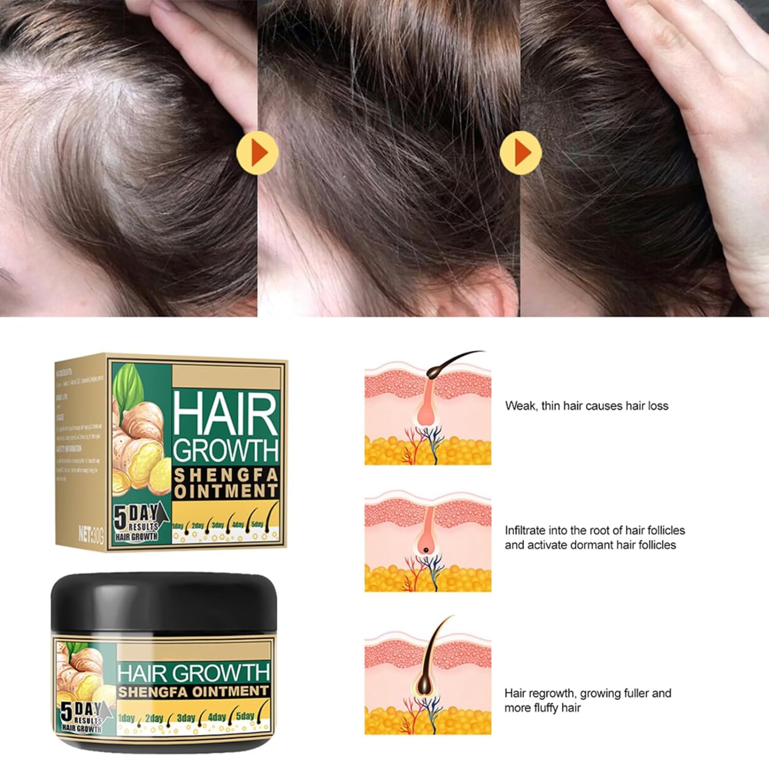 HAIR GROWTH -Mascarilla de Crecimiento de cabello.