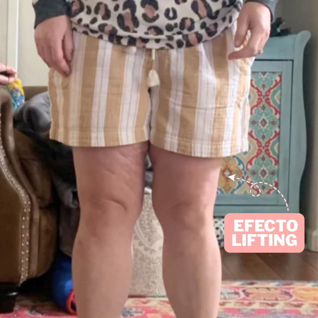 DERMALIFT PACK X 30 / Lifting de piernas