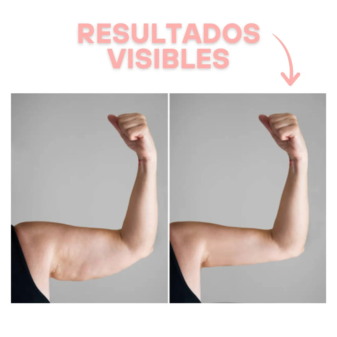 SiluForma® / Chaleco Moldeador de Brazos
